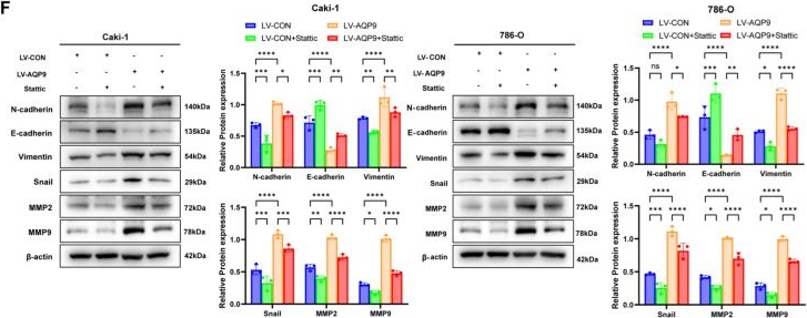 Fig.5.F showing Western Blotting from the publication: Tedizolid Targets AQP9-JAK/STAT Axis to Suppress Metastatic Progression in Clear Cell Renal Cell Carcinoma: Mechanism and Therapeutic Implications.