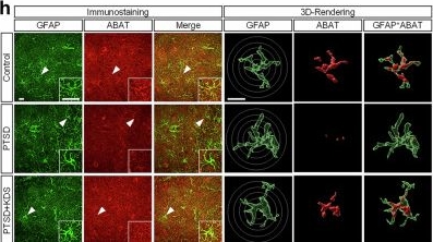 Fig.7.H showing Immunocytochemistry-immunofluorescence in a Mus musculus (House mouse) sample from the publication: Astrocytic gamma-aminobutyric acid dysregulation as a therapeutic target for posttraumatic stress disorder.