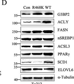Fig.4.D showing Western Blotting from the publication: USP7- and PRMT5-dependent G3BP2 stabilization drives de novo lipogenesis and tumorigenesis of HNSC.