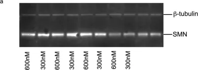 Fig.5.A showing Western Blotting in a Mus musculus (House mouse) sample from the publication: Improved antisense oligonucleotide design to suppress aberrant SMN2 gene transcript processing: towards a treatment for spinal muscular atrophy.