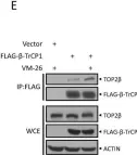 Fig.2.E showing Western Blotting in a Homo sapiens (Human) sample from the publication: SCFβ-TrCP-mediated degradation of TOP2β promotes cancer cell survival in response to chemotherapeutic drugs targeting topoisomerase II.