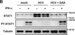 Fig.2.B showing Western Blotting in a Homo sapiens (Human) sample from the publication: IFN-λ4 potently blocks IFN-α signalling by ISG15 and USP18 in hepatitis C virus infection.
