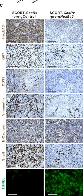 Fig.6.C showing Immunohistochemistry in a Mus musculus (House mouse) sample from the publication: SCORT-Cas13d Nanotherapy Precisely Targets the 'Undruggable' Transcription Factor HoxB13 in Metastatic Prostate Cancer In Vivo.