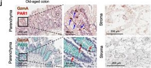 Fig.6.J showing Immunohistochemistry in a Mus musculus (House mouse) sample from the publication: Distribution and impact of p16INK4A+ senescent cells in elderly tissues: a focus on senescent immune cell and epithelial dysfunction.