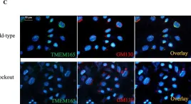 Fig.1.C showing Immunocytochemistry-immunofluorescence from the publication: TMEM165 a new player in proteoglycan synthesis: loss of TMEM165 impairs elongation of chondroitin- and heparan-sulfate glycosaminoglycan chains of proteoglycans and triggers early chondrocyte differentiation and hypertrophy.