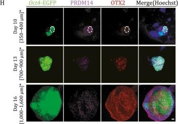 Fig.7.H showing Immunocytochemistry-immunofluorescence from the publication: The chemical reprogramming of unipotent adult germ cells towards authentic pluripotency and de novo establishment of imprinting.