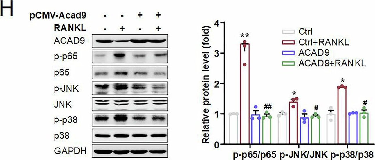 Fig.4.H showing Western Blotting from the publication: Moonlighting cytosolic function of ACAD9: suppression of TRAF6-mediated osteoclastogenesis and protection against osteoporosis.