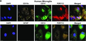 Fig.5.A showing Immunocytochemistry-immunofluorescence in a Homo sapiens (Human) sample from the publication: Immortalization of primary microglia: a new platform to study HIV regulation in the central nervous system.
