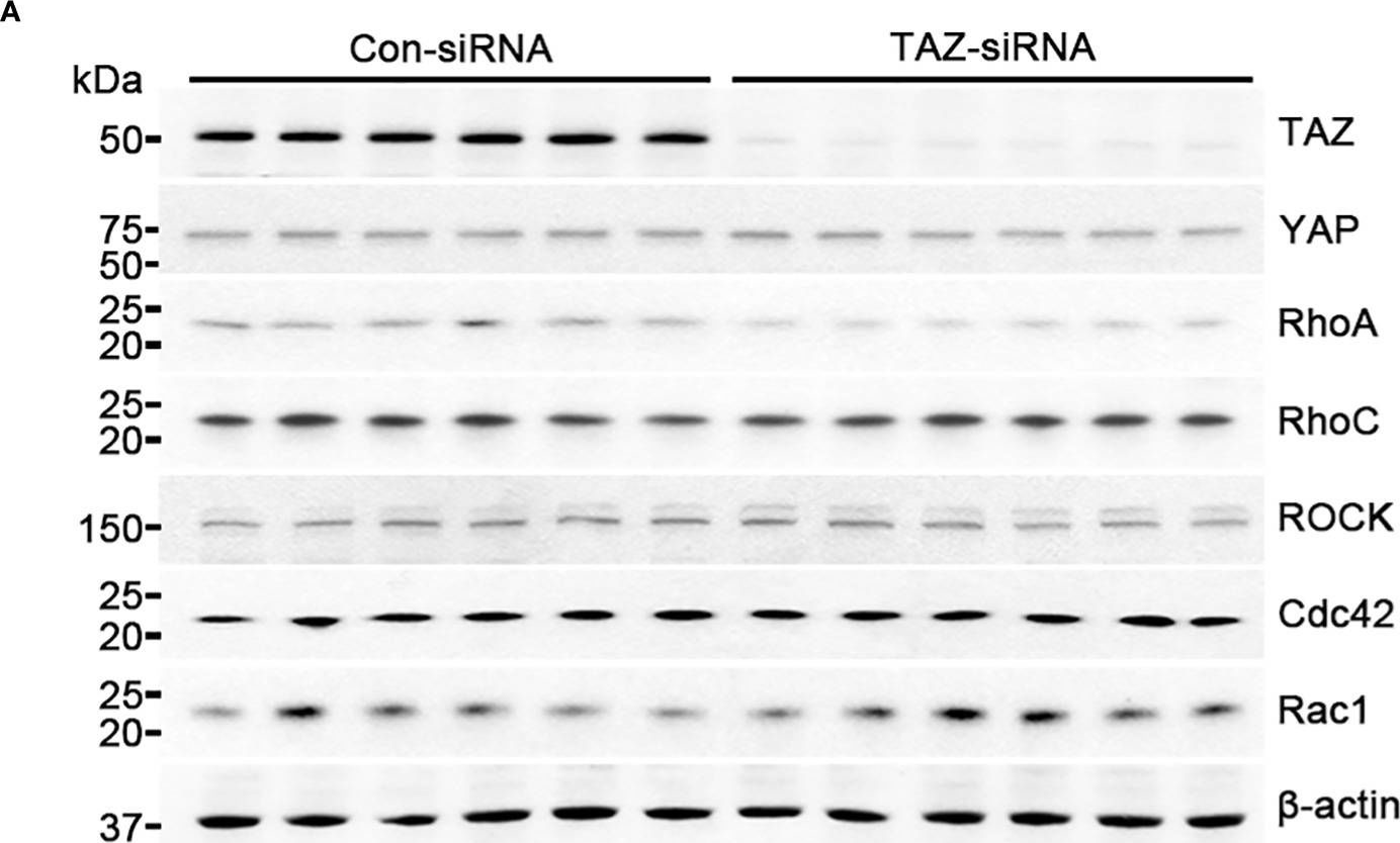 Fig.4.A showing Western Blotting in a Homo sapiens (Human) sample from the publication: TAZ is involved in breast cancer cell migration via regulating actin dynamics.
