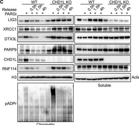 Fig.4.C showing Western Blotting in a Homo sapiens (Human) sample from the publication: CHD1L maintains genome integrity by facilitating okazaki fragment maturation.