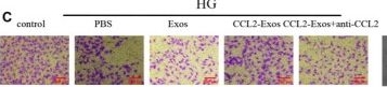 Fig.7.C showing Immunohistochemistry in a Homo sapiens (Human) sample from the publication: Single-Cell Sequencing Reveals That CCL2+ Adipose-Derived Stem Cells Promote Diabetic Wound Healing Through the CCL2-ACKR1 Signaling Axis.