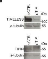 Fig.1.A showing Western Blotting in a Homo sapiens (Human) sample from the publication: Transcription-replication conflicts underlie sensitivity to PARP inhibitors.