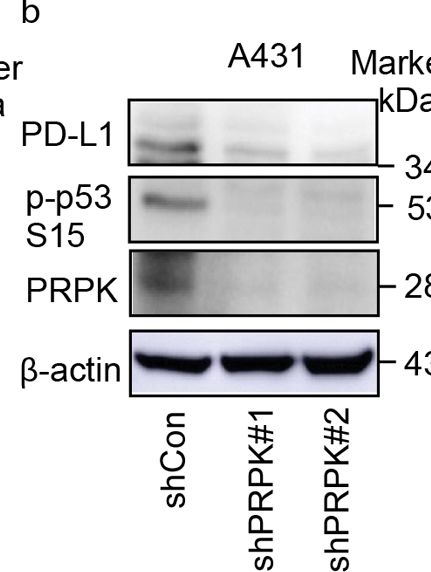 Fig.3.B showing Western Blotting in a Homo sapiens (Human) sample from the publication: Deletion of p53-Related Protein Kinase Suppresses Solar UV-Induced Photocarcinogenesis by Inhibiting PD-L1 Expression and Enhancing CD8 T-Cell Infiltration.