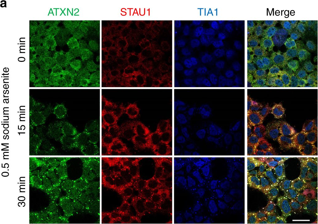 Fig.1.A showing Immunofluorescence in a Mus musculus (House mouse) sample from the publication: Staufen1 links RNA stress granules and autophagy in a model of neurodegeneration.