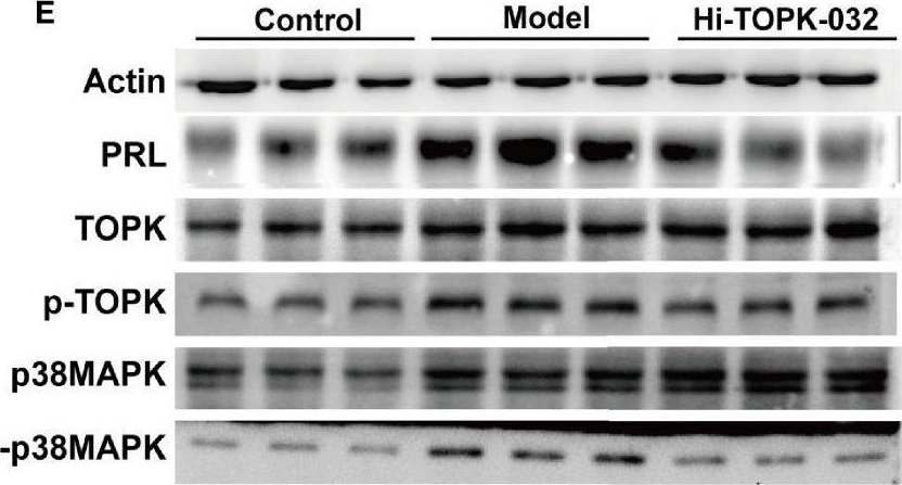Fig.5.E showing Western Blotting in a Rattus norvegicus (Rat) sample from the publication: PBK/TOPK Inhibitor Suppresses the Progression of Prolactinomas.