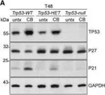 Fig.6.A showing Western Blotting from the publication: Centrosome function is critical during terminal erythroid differentiation.