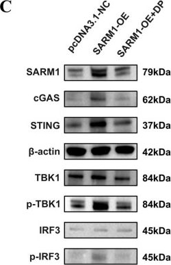 Fig.5.C showing Western Blotting from the publication: D-Pinitol Mitigates Renal Senescence via Targeting the SARM1-cGAS-STING Signaling Axis to Restore Mitochondrial Function and Dampen Inflammatory Responses.
