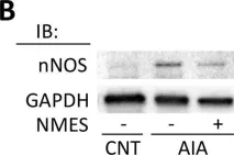 Fig.4.B showing Western Blotting from the publication: Neuromuscular electrical stimulation prevents skeletal muscle dysfunction in adjuvant-induced arthritis rat.