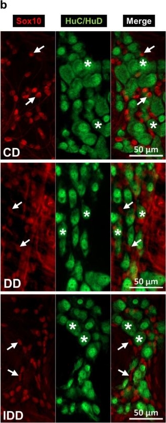 Fig.4.B showing Immunocytochemistry-immunofluorescence in a Rattus norvegicus (Rat) sample from the publication: Enteric Glial Network in Diabetes: Quantitative Changes of Glial Density in Rats in Response to Acute and Chronic Hyperglycaemia.