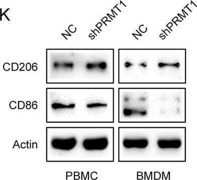 Fig.4.K showing Western Blotting from the publication: Tumor-derived PRMT1 suppresses macrophage antitumor activity by inhibiting cGAS/STING signaling in gastric cancer cells.