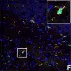 Fig.7.F showing Immunohistochemistry-immunofluorescence in a Mus musculus (House mouse) sample from the publication: IFN-gamma signaling in the central nervous system controls the course of experimental autoimmune encephalomyelitis independently of the localization and composition of inflammatory foci.