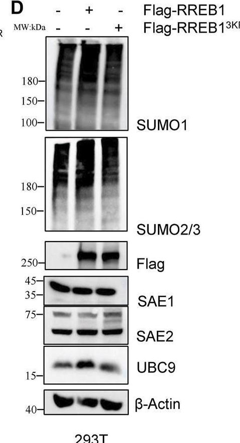Fig.6.D showing Western Blotting in a Homo sapiens (Human) sample from the publication: RREB1-mediated SUMOylation enhancement promotes chemoresistance partially by transcriptionally upregulating UBC9 in colorectal cancer.
