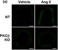 Fig.6.A showing Immunocytochemistry-immunofluorescence in a Rattus norvegicus (Rat) sample from the publication: Critical role of the β isoform of protein kinase C (PKCβ) in angiotensin II-induced oxidative stress in vascular smooth muscle cells.