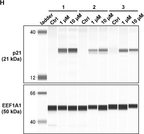 Fig.3.H showing Western Blotting from the publication: An ALKBH3 Inhibitor HUHS199 Suppresses Proliferation of Glioblastoma Cells by Targeting 1-Methyladenosine on GADD45A mRNA.