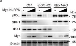 Fig.4.Y showing Western Blotting in a Homo sapiens (Human) sample from the publication: NLRP6 potentiates PI3K/AKT signalling by promoting autophagic degradation of p85α to drive tumorigenesis.