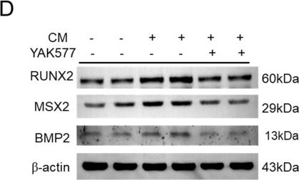 Fig.3.D showing Western Blotting from the publication: YAK577 Attenuates Vascular Calcification by Targeting an MMP14-NOX2/ROS Axis in VSMCs and a Vitamin D3-Induced Mouse Model.
