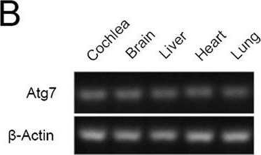 Fig.1.B showing Western Blotting in a Mus musculus (House mouse) sample from the publication: Disruption of Atg7-dependent autophagy causes electromotility disturbances, outer hair cell loss, and deafness in mice.