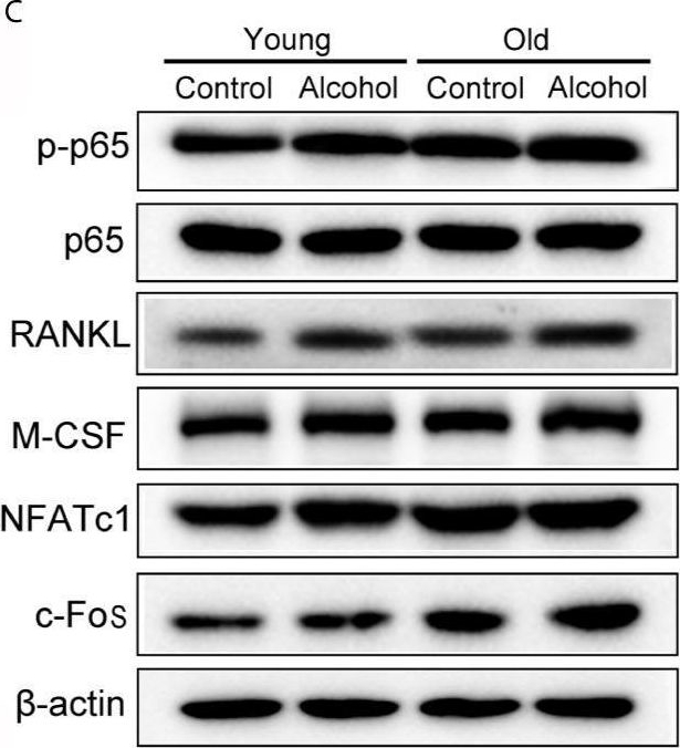 Fig.2.U showing Western Blotting in a Rattus norvegicus (Rat) sample from the publication: Gut Microbiota Is Involved in Alcohol-Induced Osteoporosis in Young and Old Rats Through Immune Regulation.