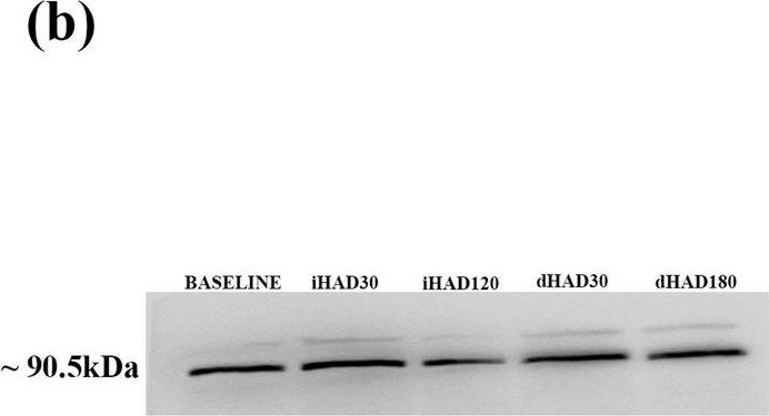 Fig.3.B showing Western Blotting in a Homo sapiens (Human) sample from the publication: Quantifying systemic molecular networks affected during high altitude de-acclimatization.