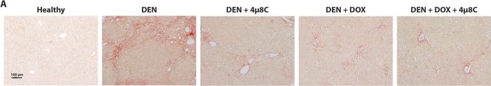 Fig.3.A showing Immunohistochemistry from the publication: Inhibiting the endoplasmic reticulum stress response enhances the effect of doxorubicin by altering the lipid metabolism of liver cancer cells.