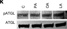 Fig.4.K showing Western Blotting from the publication: Enhanced lipid metabolism serves as a metabolic vulnerability to polyunsaturated fatty acids in glioblastoma.