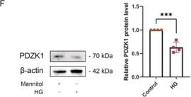 Fig.1.F showing Western Blotting from the publication: PDZK1 Protects Against RPE Senescence by Targeting the 14-3-3ε-mTOR Axis to Attenuate Early Diabetic Retinopathy.