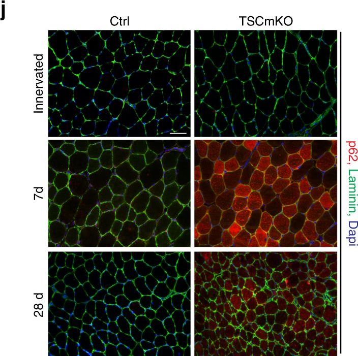 mTORC1 and PKB/Akt control the muscle response to denervation by regulating autophagy and HDAC4.