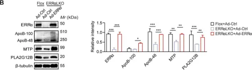 Fig.3.B showing Western Blotting from the publication: Dysfunction of estrogen-related receptor alpha-dependent hepatic VLDL secretion contributes to sex disparity in NAFLD/NASH development.