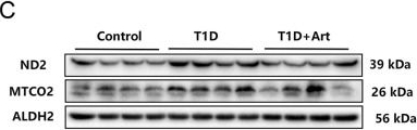 Fig.4.C showing Western Blotting in a Mus musculus (House mouse) sample from the publication: Artemether ameliorates type 1 diabetic liver injury alongside the associated defects in mitochondrial ultrastructure and central carbon metabolism.