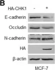 Fig.6.B showing Western Blotting from the publication: Checkpoint Kinase 1 (CHK1) Functions as Both a Diagnostic Marker and a Regulator of Epithelial-to-Mesenchymal Transition (EMT) in Triple-Negative Breast Cancer.