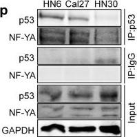 Fig.2.P showing Western Blotting in a Homo sapiens (Human) sample from the publication: p53-targeted lincRNA-p21 acts as a tumor suppressor by inhibiting JAK2/STAT3 signaling pathways in head and neck squamous cell carcinoma.