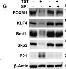 Fig.8.G showing Western Blotting in a Homo sapiens (Human) sample from the publication: Targeting FOXM1 regulates metabolic signatures through ROS-dependent JNK/Bmi1/Skp2 axis in human cutaneous T-cell lymphoma.