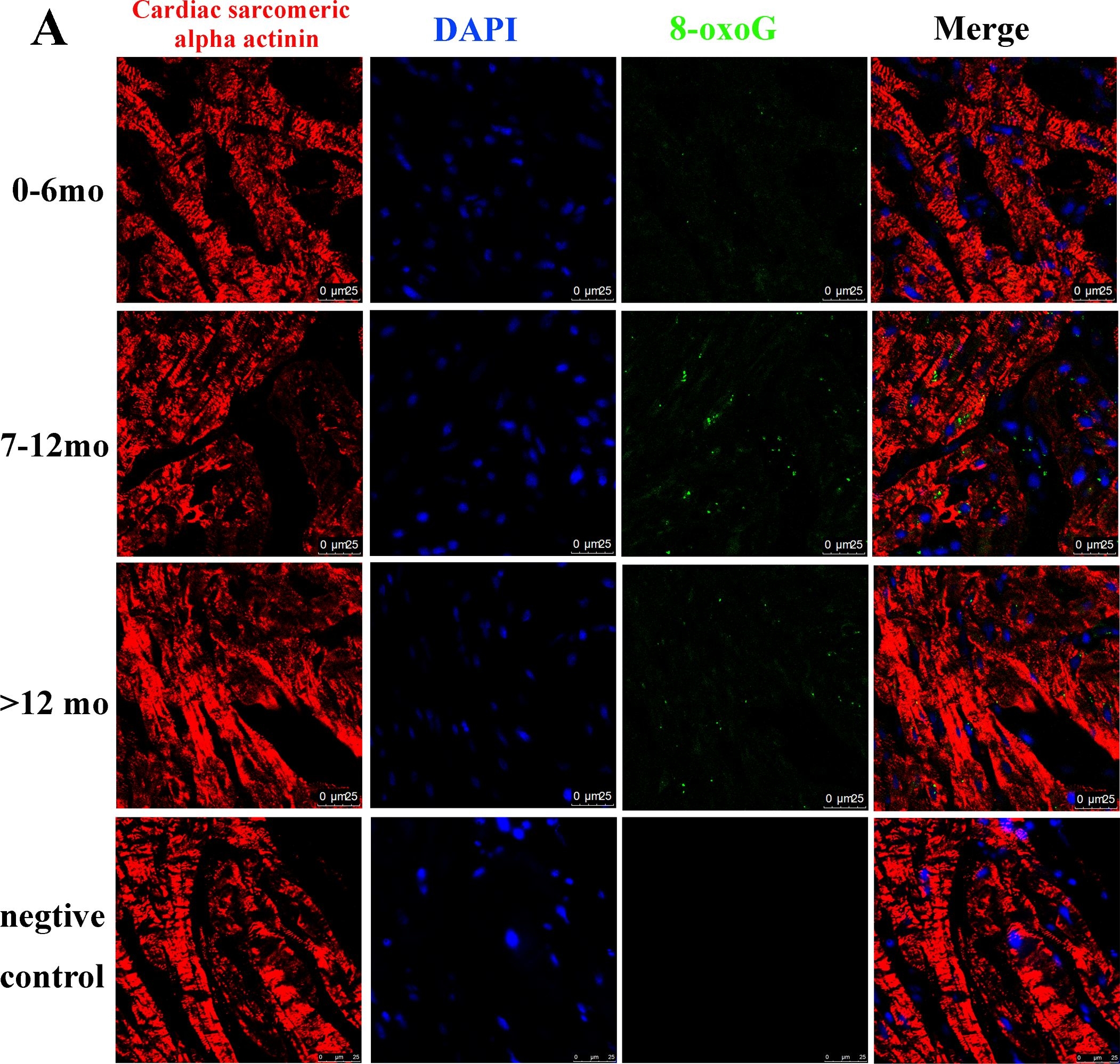 Fig.2.A showing Immunocytochemistry-immunofluorescence in a Homo sapiens (Human) sample from the publication: Age-Dependent Oxidative DNA Damage Does Not Correlate with Reduced Proliferation of Cardiomyocytes in Humans.