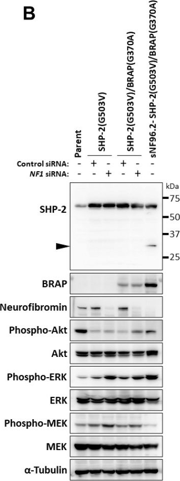 Fig.6.B showing Western Blotting from the publication: Mutation of PTPN11 (Encoding SHP-2) Promotes MEK Activation and Malignant Progression in Neurofibromin-Deficient Cells in a Manner Sensitive to BRAP Mutation.