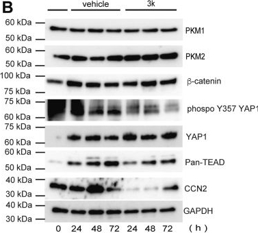 Fig.8.B showing Western Blotting from the publication: PKM2 inhibitor suppresses kidney fibrogenesis by disrupting YAP-TEAD-CCN2 transcriptional signaling following ischemia-reperfusion injury.