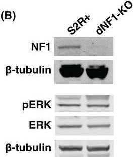 Fig.1.B showing Western Blotting in a Drosophila melanogaster (Fruit fly) sample from the publication: Inhibition of autophagy as a novel treatment for neurofibromatosis type 1 tumors.