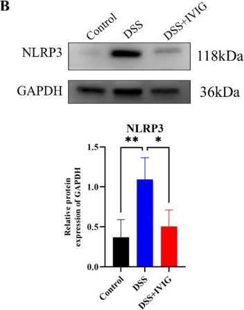 Fig.6.B showing Western Blotting from the publication: Intravenous Immunoglobulin Reveals a Novel Protective Mechanism: Targeting the GBP5-Driven Pyroptosis Axis in Experimental Colitis.
