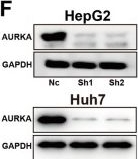 Fig.2.F showing Western Blotting in a Homo sapiens (Human) sample from the publication: AURKA suppresses NCOA4-mediated ferritinophagy to enhance sorafenib resistance in hepatocellular carcinoma.