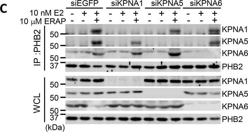 Fig.4.C showing Western Blotting in a Homo sapiens (Human) sample from the publication: BIG3 Inhibits the Estrogen-Dependent Nuclear Translocation of PHB2 via Multiple Karyopherin-Alpha Proteins in Breast Cancer Cells.