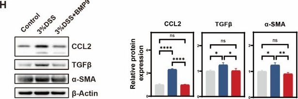 Fig.3.H showing Western Blotting in a Mus musculus (House mouse) sample from the publication: Recombinant BMP9 Reinforces Gut Vascular Barrier in Experimental Colitis.